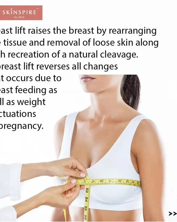 A breast lift is designed to reverse the effects of gravity, breastfeeding, and weight changes. The procedure works by raising the breast tissue and removing loose skin to restore a more youthful position and a natural cleavage.
