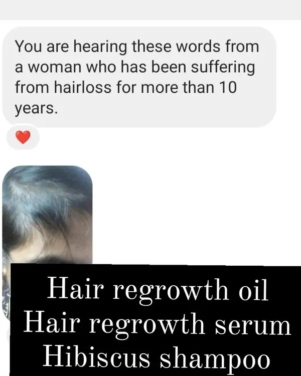 This message was so powerful to read. To help someone who has been suffering from hair loss for over 10 years is the reason I do what I do. She found relief with my hair regrowth oil, serum, and hibiscus shampoo.