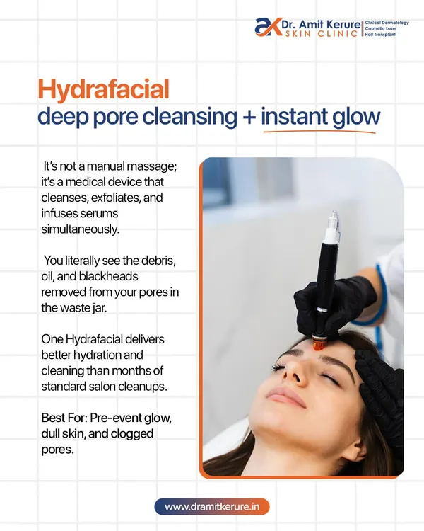 This graphic explains how a Hydrafacial provides deep pore cleansing and an instant glow. Unlike manual facials, this medical device cleanses, exfoliates, and infuses serums simultaneously for superior hydration.